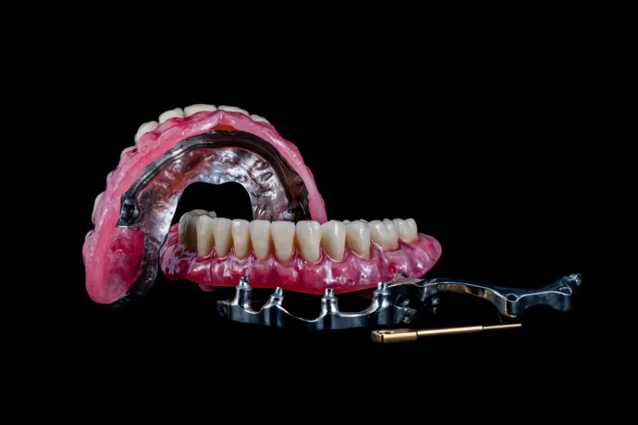 all on 4 implants