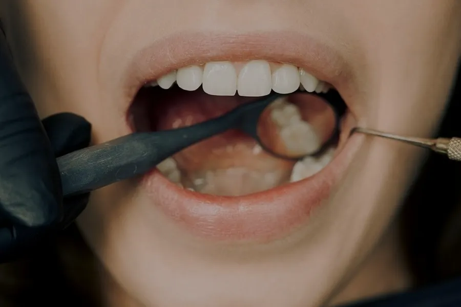 davis dental crown lengthening