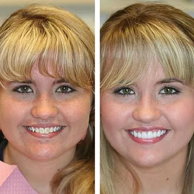 davis dental smiles 1