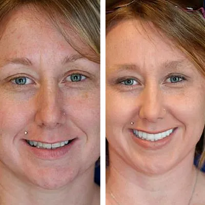 davis dental smiles 11
