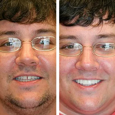 davis dental smiles 3