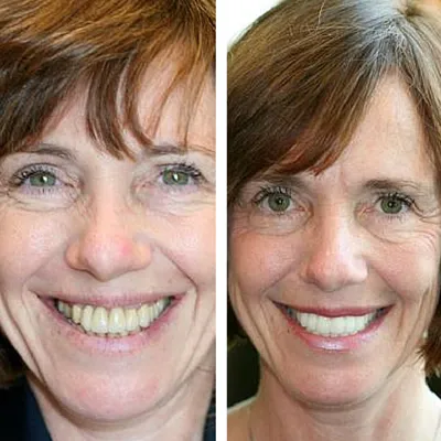 davis dental smiles 6