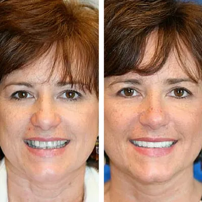 davis dental smiles 7