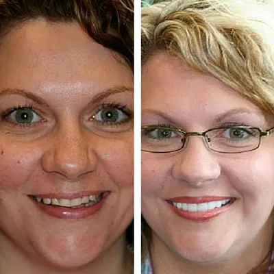 davis dental smiles 8