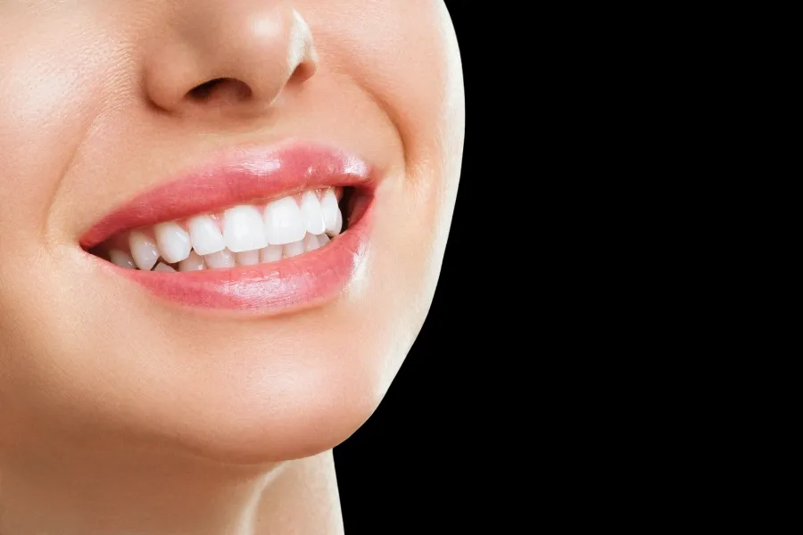 davis dental teeth whitening