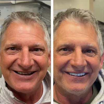 dental smile