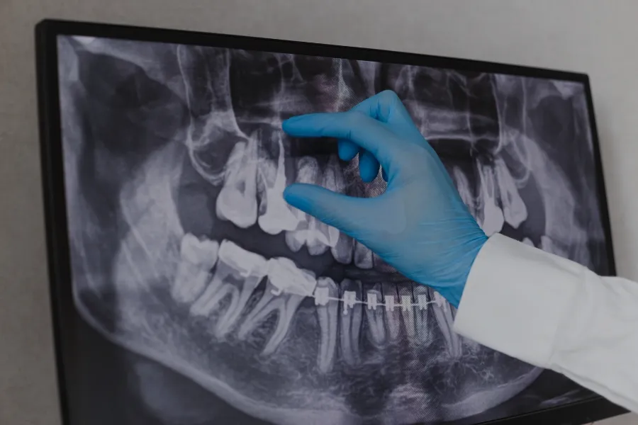 dental technology