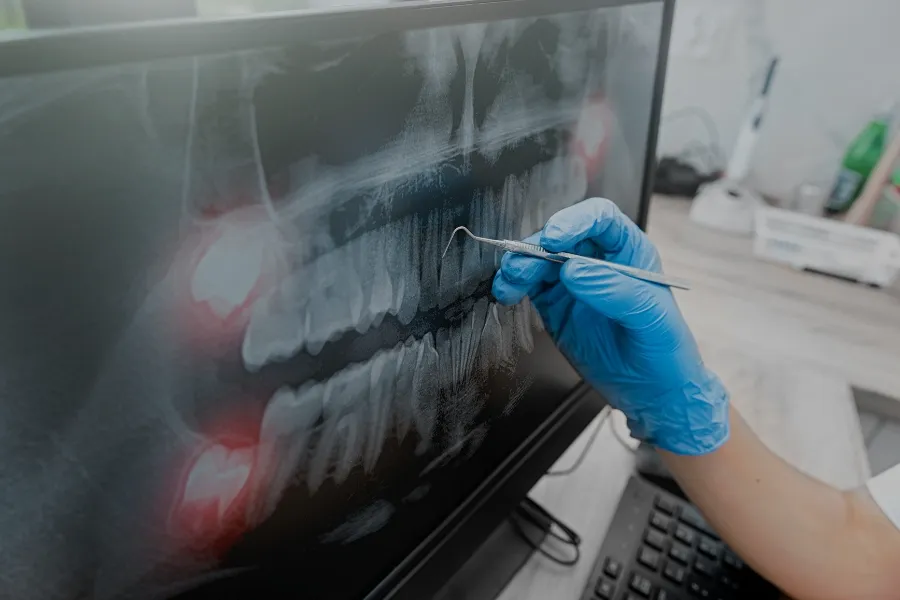 dental x ray