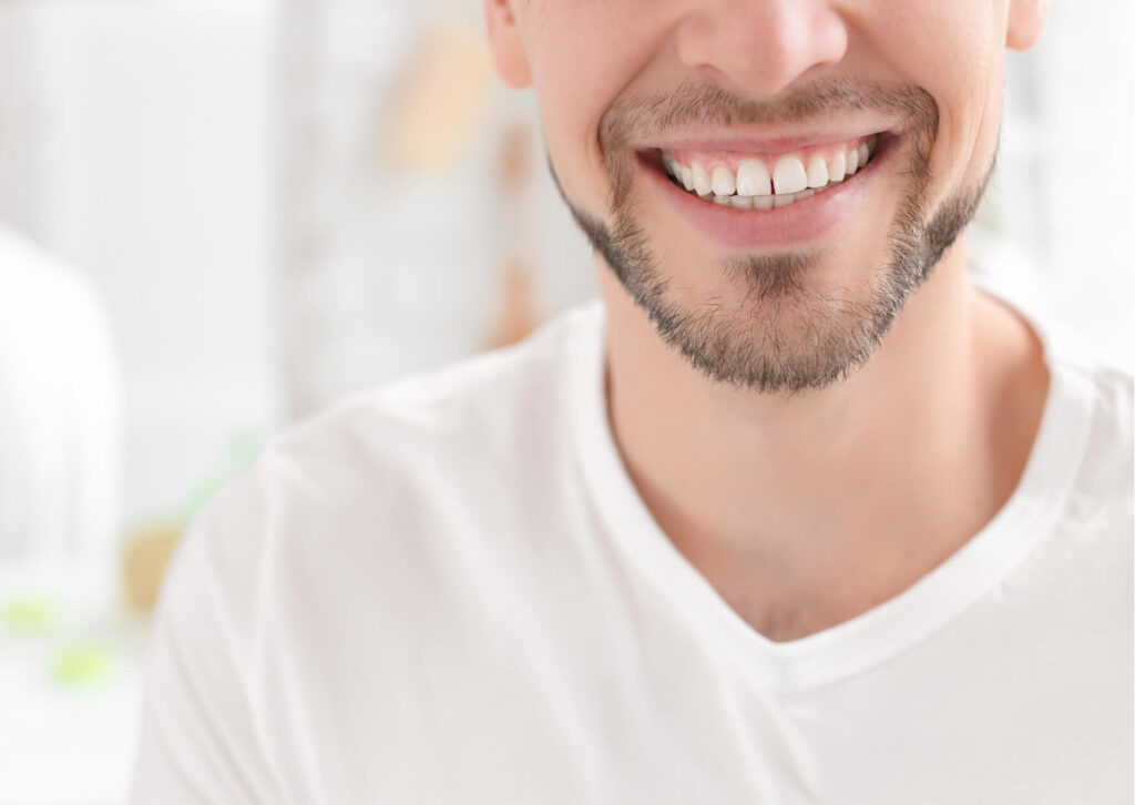Man smiling with noticeably whiter teeth after cosmetic dental treatment, illustrating the results of professional teeth whitening options.